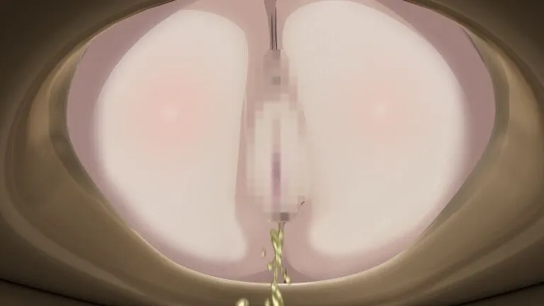 替代文字